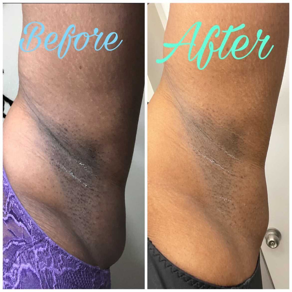 Pussy Fairy Intimate Scrub