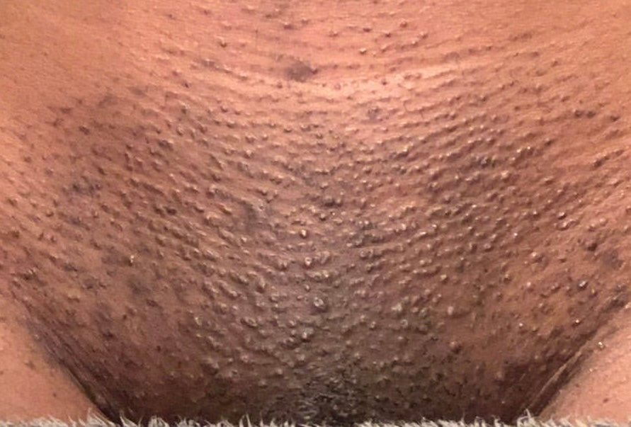 Pussy Fairy Intimate Scrub