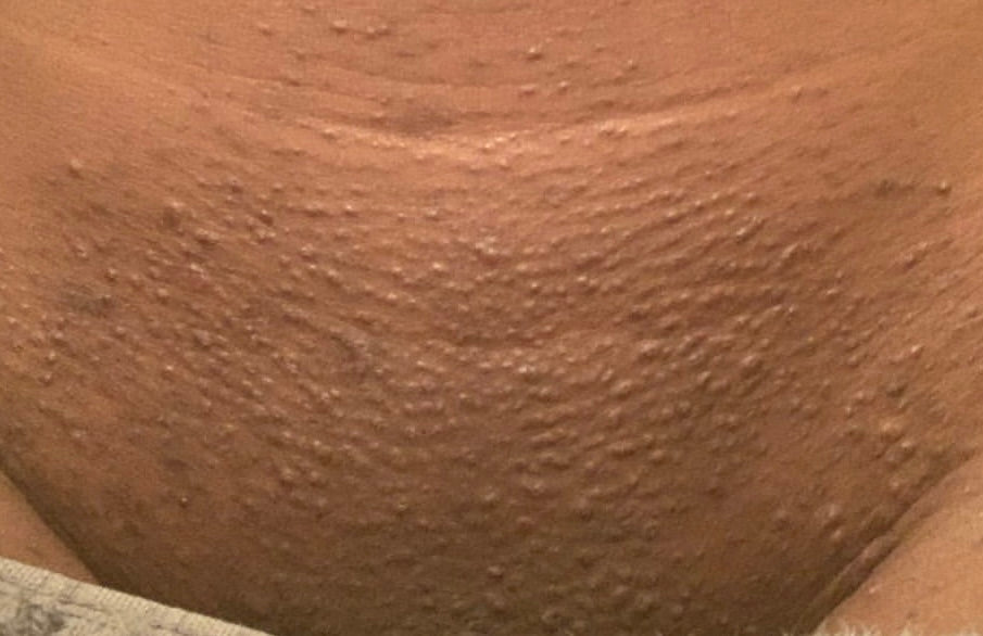 Pussy Fairy Intimate Scrub