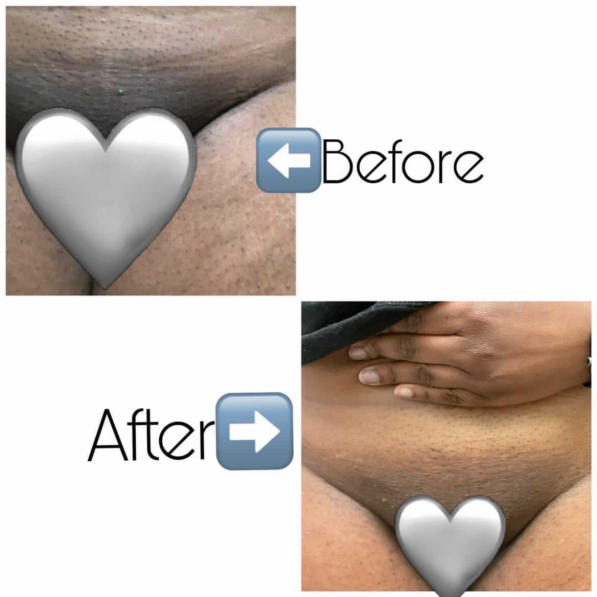 Pussy Fairy Intimate Scrub