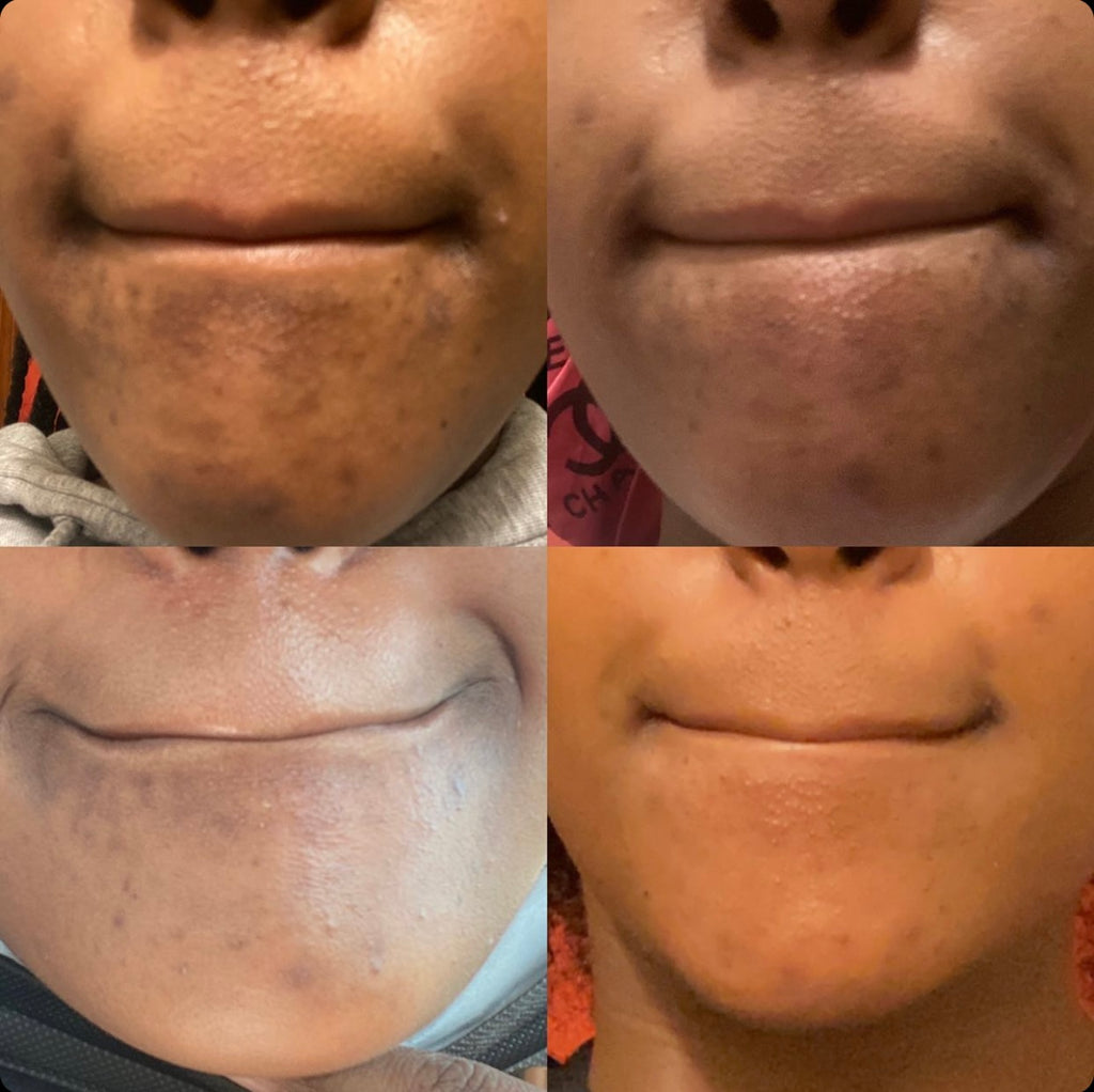 Complexion Correction System