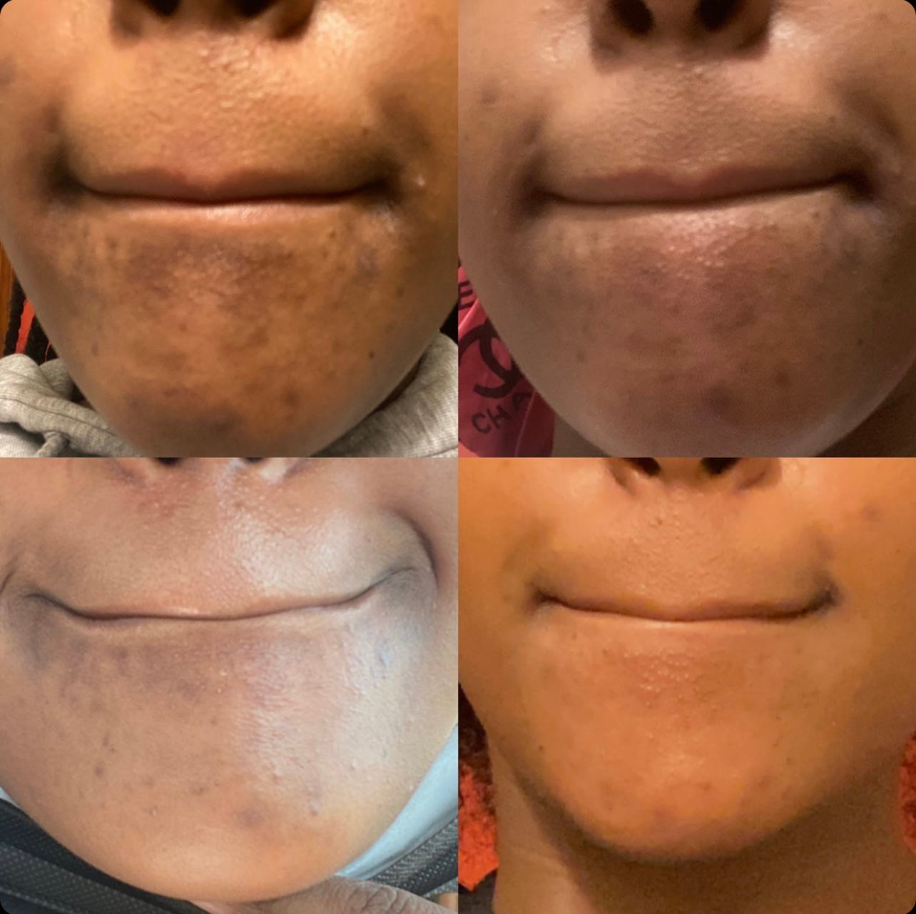 Complexion Correction System